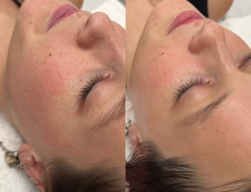 First Time Facial? Here’s What You Can Expect: